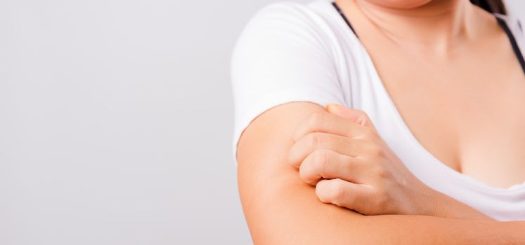 Asian beautiful woman itching her useing hand scratch itch Arm on white background with copy space, Medical and Healthcare concept