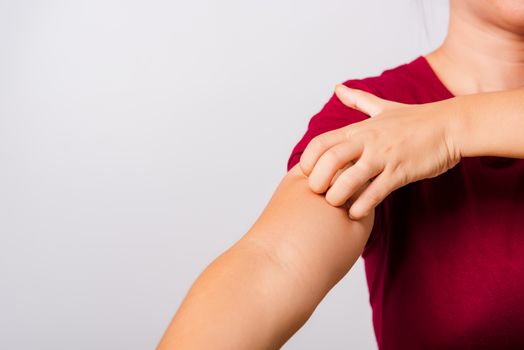 Asian beautiful woman itching her scratching her itchy arm on white background with copy space, Medical and Healthcare concept