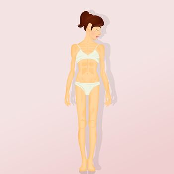 illustration of anorexia