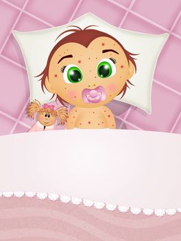 illustration of child in bed with measles