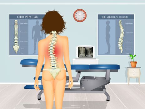 illustration of girl with scoliosis problem