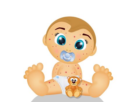 illustration of baby with measles