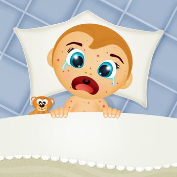 illustration of baby with measles cries