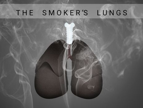 illustration of The smoker's lungs