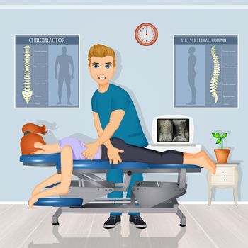 illustration of chiropractic adjustment