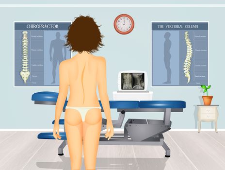 illustration of girl with scoliosis problem