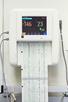 Close up of a fetal monitor or non stress test printing baby heartbeats, electrocardiograph and mother uterine contraction in Labor and delivery room at hospital.