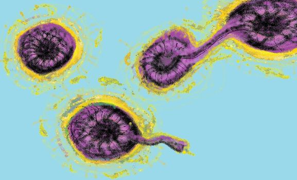 Microscope art illustration of coronavirus spreading and growing