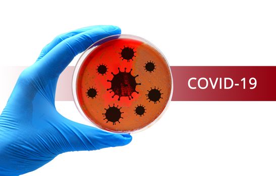 laboratory doctor hand coronavirus covid-19 virus test