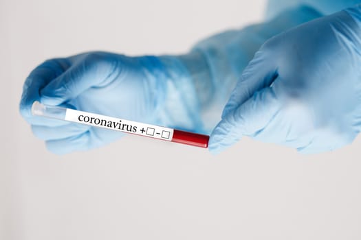 Close up of doctor hand holding blood sample. Medical equipment. Blood test. A doctor wearing personal protective equipment including mask, goggle, and suit to protect COVID 19 coronavirus infection.