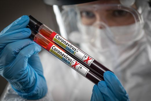 Female Lab Worker Holds Test Tubes of Blood Labeled Coronavirus COVID-19 Disease.