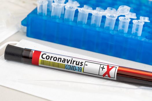 Positive Coronavirus Blood Test Tube Laying on Lab Table.