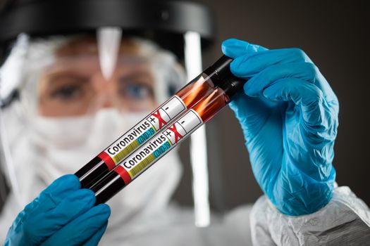 Female Doctor or Nurse Holding Test Tubes of Blood Labeled Positive for Coronavirus COVID-19 Disease.