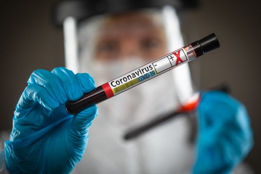 Female Doctor or Nurse Holding Test Tube of Blood Labeled Positive for Coronavirus COVID-19 Disease.