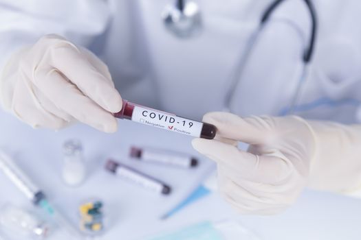 Doctor hands with protective gloves holding COVID 19 Coronavirus test blood. Virus test and research concept