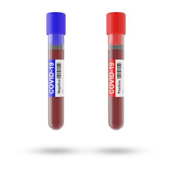 Blood and plasma in test tubes that have been analyzed for COVID-19, 2019-ncov or coronavirus to find a way to stop pandemic. Blue tube, result Negative and Red tube, result positive in laboratory.