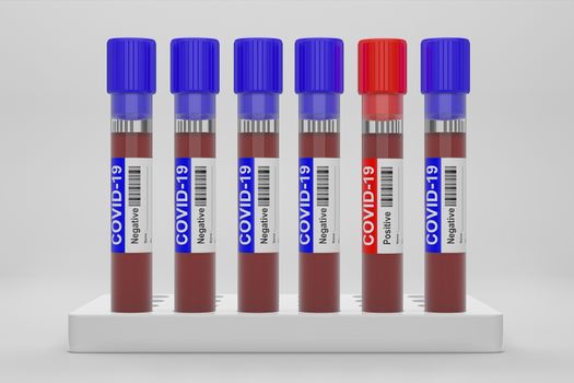 Blood and plasma in test tubes that have been analyzed for COVID-19, 2019-ncov or coronavirus to find a way to stop pandemic. Blue tube, result Negative and Red tube, result positive in laboratory.