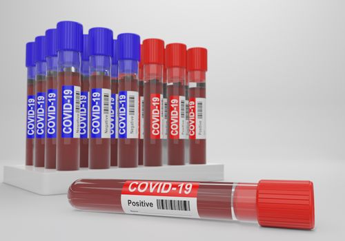 Blood and plasma in test tubes that have been analyzed for COVID-19, 2019-ncov or coronavirus to find a way to stop pandemic. Blue tube, result Negative and Red tube, result positive in laboratory.