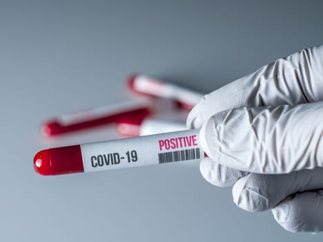 Medical glove holding a tube of blood with a positive result for test for Covid-19 or coronavirus