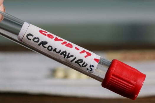 Coronavirus alias COVID -19 text on blood tube