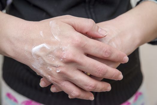 Woman putting moisturizer cream on hands with very dry skin