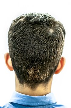 Backside shot of a young teenager affected by premature Grey isolated on white.