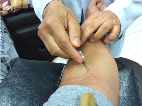 horizontal photo of closeup asian male get injection on his arm before blood donation 