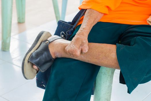 closeup foot and hand of old asian man suffering from leprosy