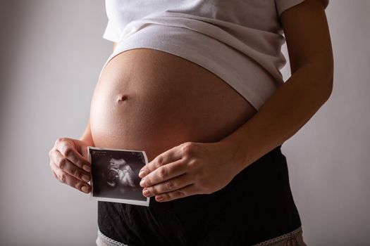Pregnant woman looks at ultrasound photo.