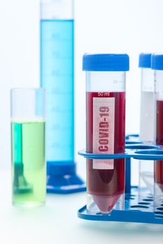 Labolatory Biochemistry Equipment on Table. Coronavirus Covie-19 Vaccine Research.