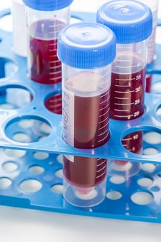 Blood Testing Samples in Laboratory. Covid-19 Blood Test Concept.