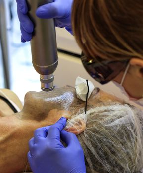 A medical professional makes a mask and laser cleansing and polishing of the skin of the face to the patient. Vertical photo.