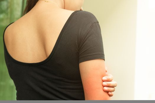 Women hand scratch the itch on arm, healthcare and medicine concept.