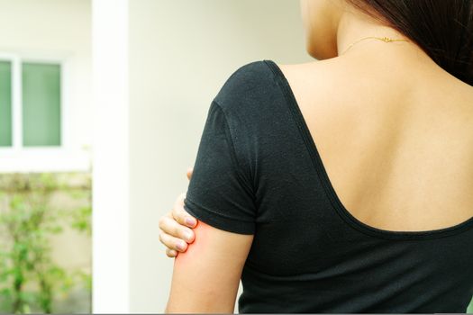 Women hand scratch the itch on arm, healthcare and medicine concept.