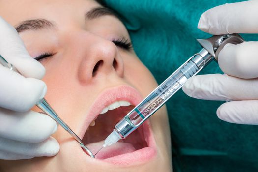 Macro close up of young girl receiving anesthesia with medical syringe.Dentist injecting needle in open mouth.