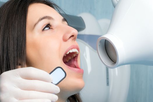 Close up portrait of young woman with open mouth next to x-ray machine in dental clinic.Assistant holding blank x-ray in front of girl.
