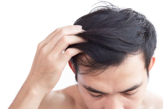 Young man serious hair loss problem for health care medical and shampoo product concept, selective focus