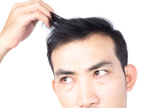 Young man serious hair loss problem for health care medical and shampoo product concept, selective focus