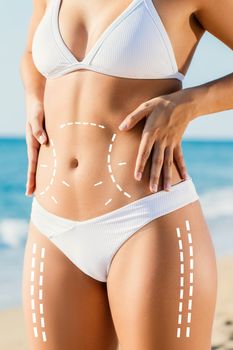 Close up detail of slim attractive female torso in white bikini outdoors.Conceptual dotted surgical incision lines marked on skin for tummy tuck.Girl touching hips with hands.