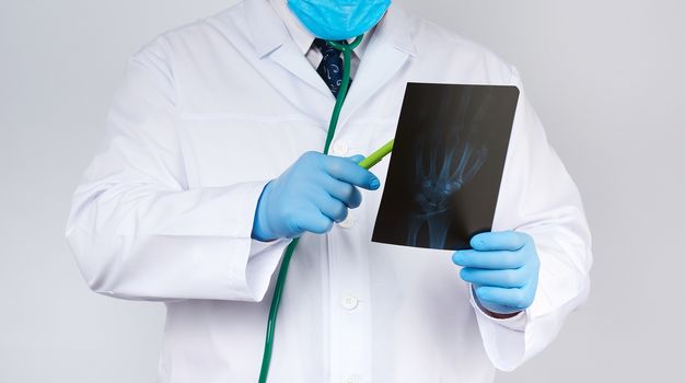 doctor in a white coat and blue latex gloves holds an x-ray of a man’s hand and conducts a visual examination, white background