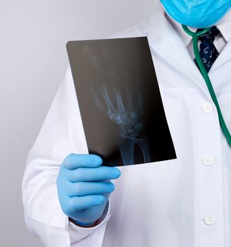 doctor in a white coat and blue latex gloves holds an x-ray of a man’s hand and conducts a visual examination, white background