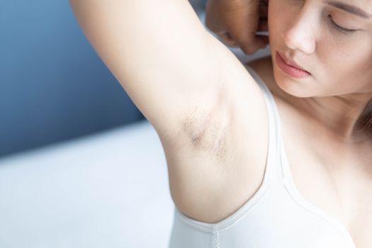 Women problem black armpit lying on white bed background for skin care and beauty concept, selective focus