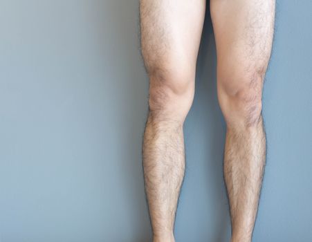 Closeup legs men skin and hairy for health care concept with grey background