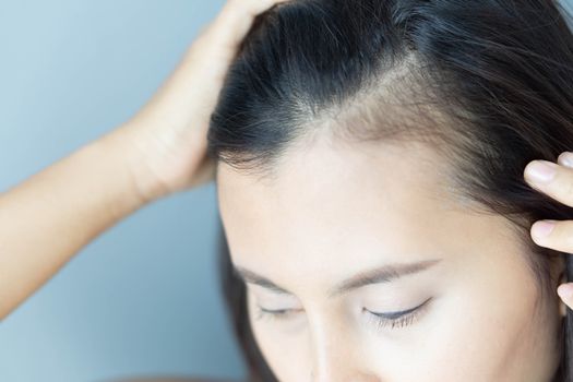 Woman serious hair loss problem for health care shampoo and beauty product concept, selective focus