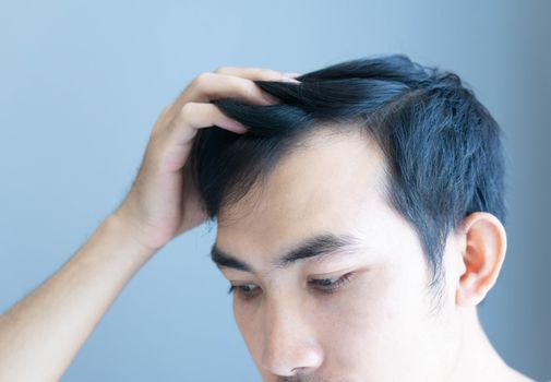 Young man serious hair loss problem for health care medical and shampoo product concept, selective focus