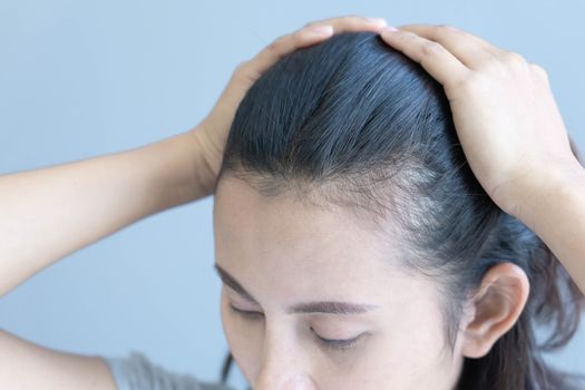 Woman serious hair loss problem for health care shampoo and beauty product concept, selective focus