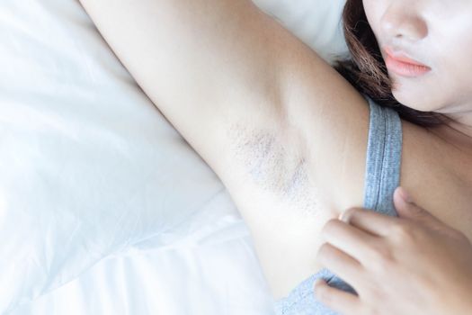 Women problem black armpit lying on white bed background for skin care and beauty concept, selective focus