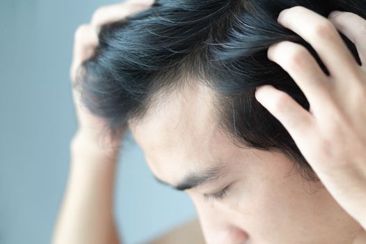 Young man serious hair loss problem for health care medical and shampoo product concept, selective focus