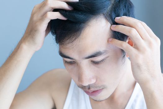 Young man serious hair loss problem for health care medical and shampoo product concept, selective focus