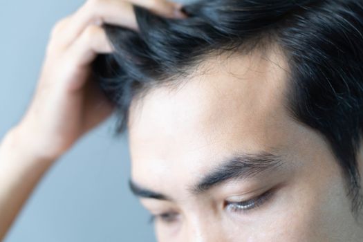 Young man serious hair loss problem for health care medical and shampoo product concept, selective focus